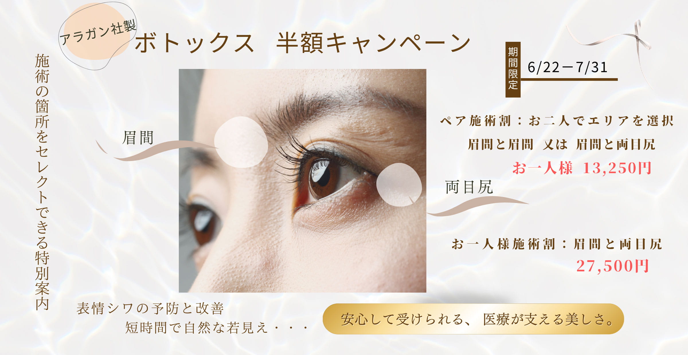 ボトックス半額キャンペーン