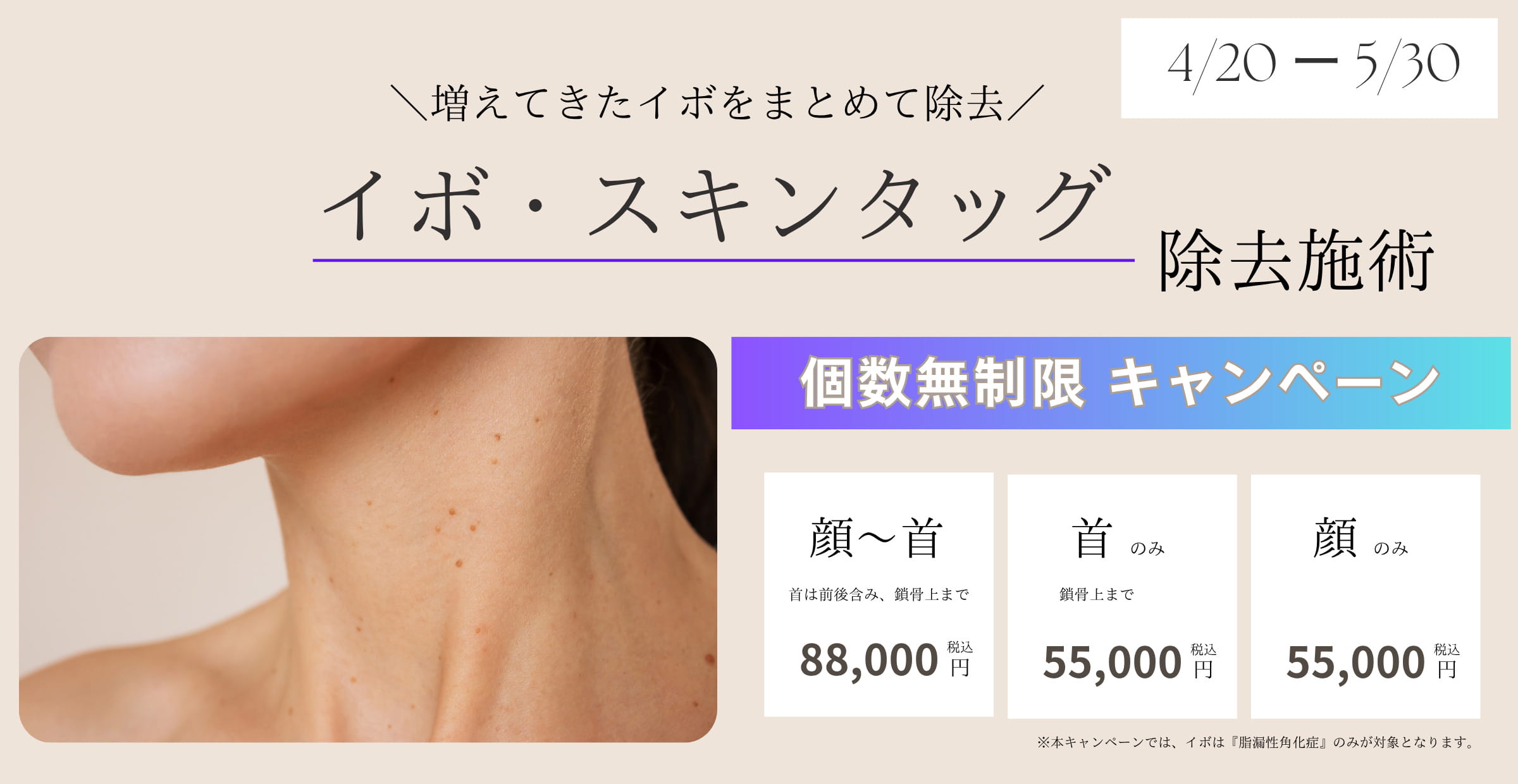 個数無制限キャンペーン