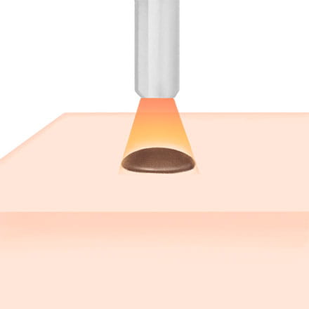 炭酸ガスレーザーイメージ図