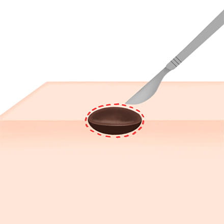 くり抜き法イメージ図