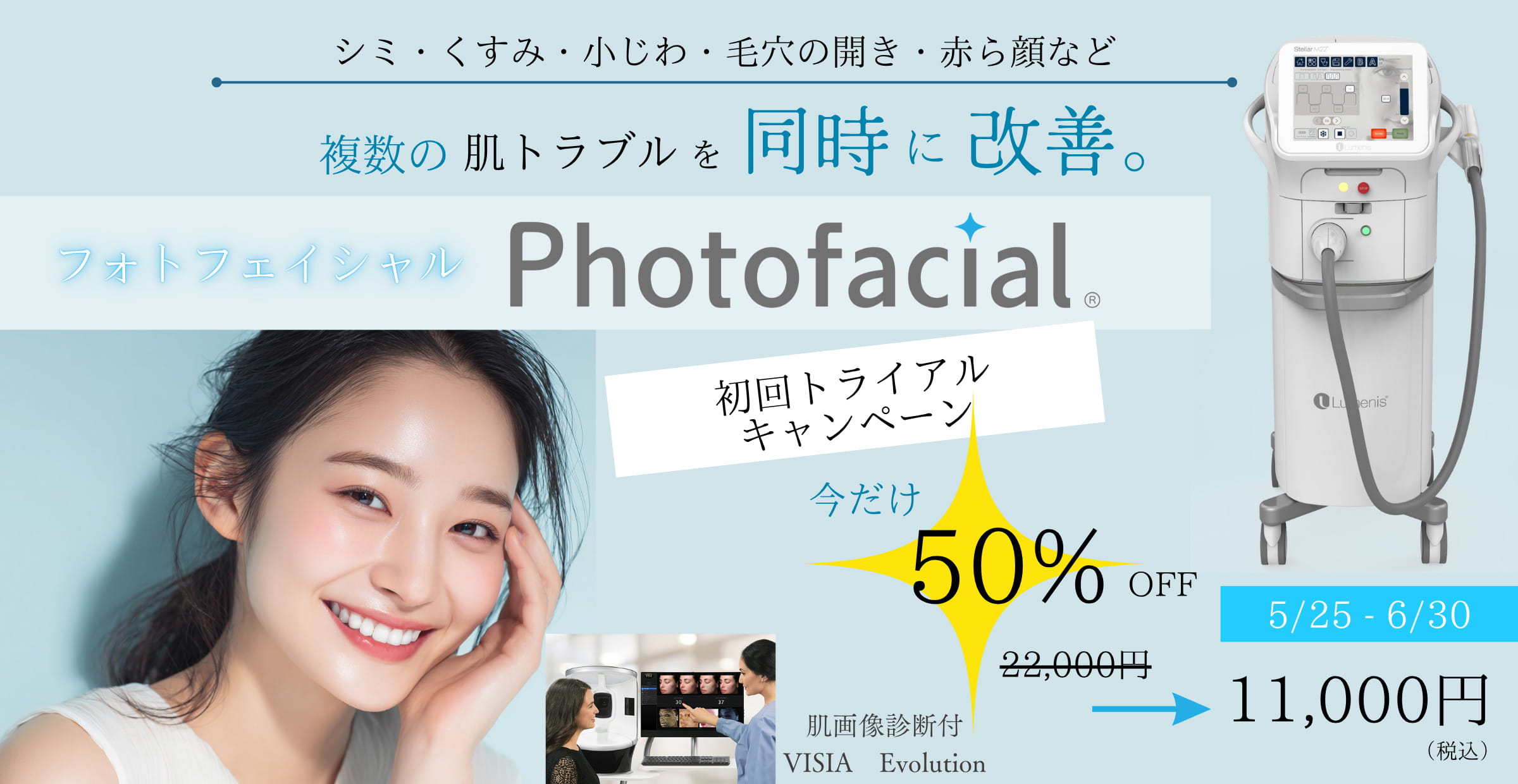 初回トライアルキャンペーン