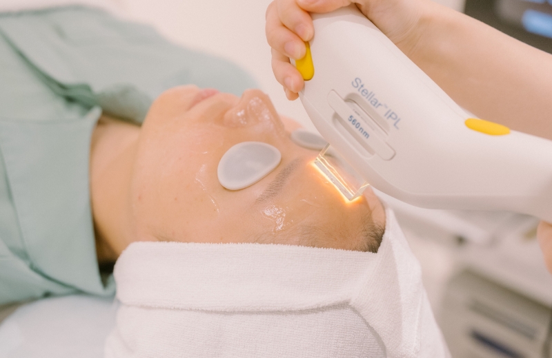 フォトフェイシャル