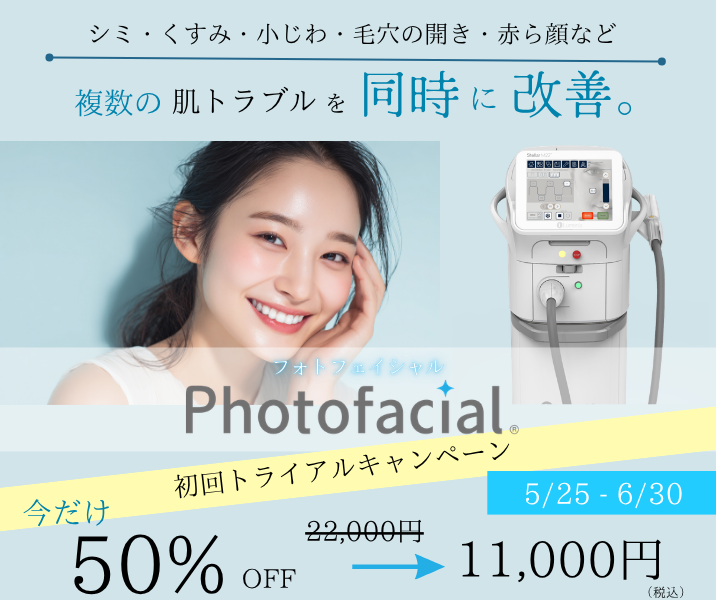【5/25-6/30　キャンペーン】フォトフェイシャル初回半額